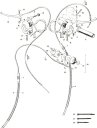 exploded view