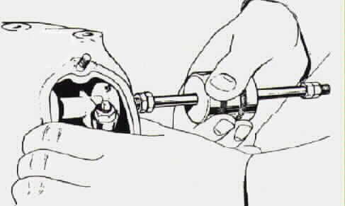 Puller in use